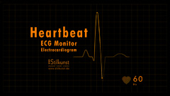EKG Elektrokardioagramm | ECG Electrocardiogram